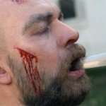 Михал Жебровский. Точные копии частей тела.