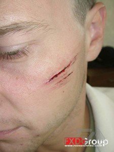 Колотые, резаные раны.Шрамы. Последствия ожогов. Переломы. Пластический грим и спецэффекты.