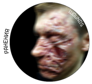 wounds