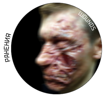 wounds